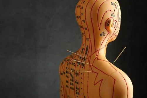 acupuncture model