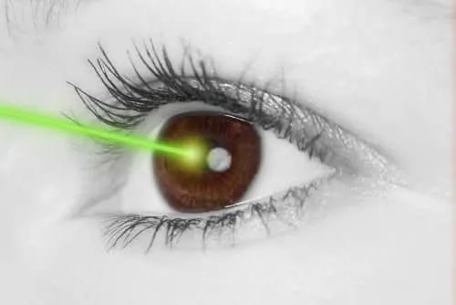 laser pointing at an eye during a LASIK procedure in Columbia, MO