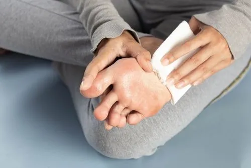 Illustration of foot sweating problem