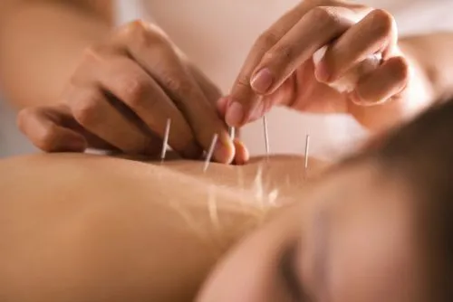 Acupuncture-FAQs-in-Greenfield-WI
