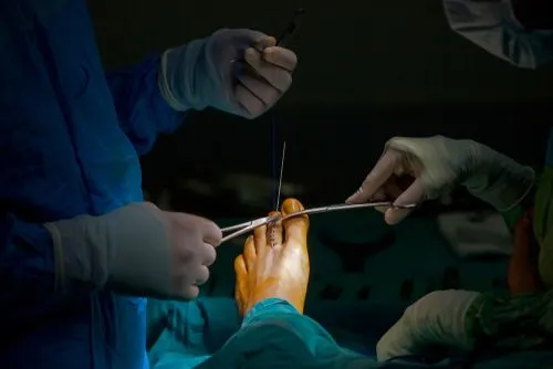 Podiatrist performing surgical procedure on patient’s foot.