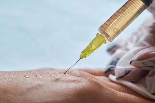 PRP injection for regenerative medicine treatment