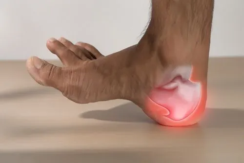 Foot showing heel spurs marked in red for pain visualization