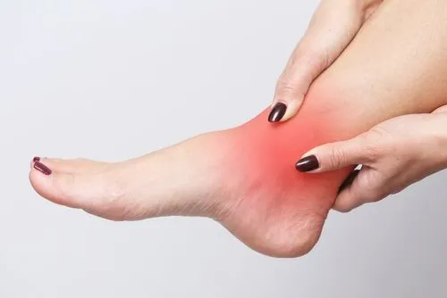 A woman holding her ankle due to chronic pain and discomfort.