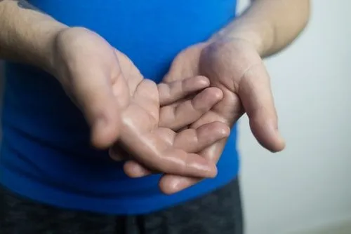 Man displaying sweaty palms due to hyperhidrosis