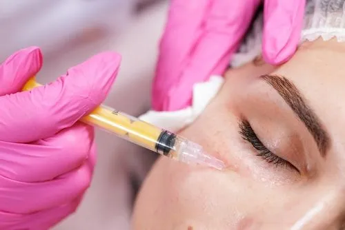 Illustration of Daxxify procedure