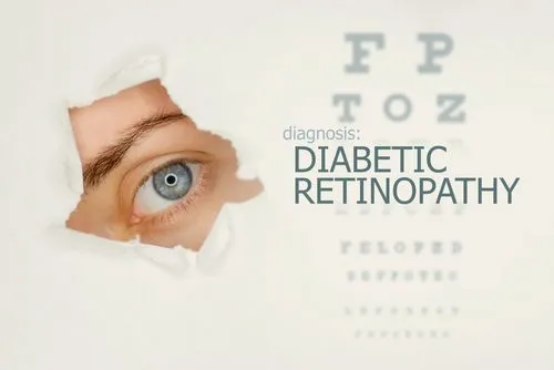 Early Detection of Diabetic Retinopathy