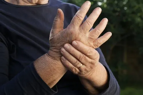 Elderly man outdoors holding his hand in pain due to arthritis