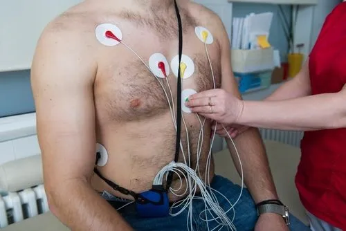 Illustration of Holter monitor