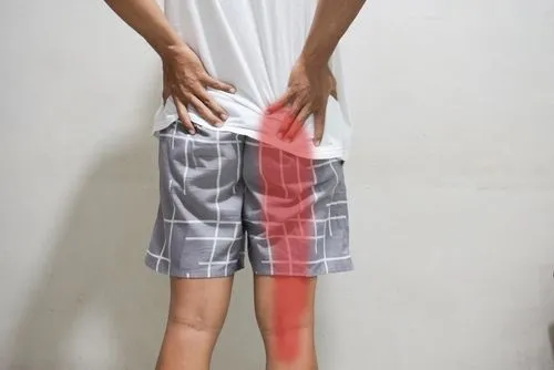 Illustration of a man showing sciatica pain path from the buttocks to the legs