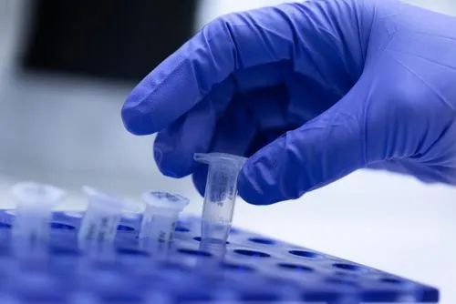 Lab professional preparing samples for PCR analysis to diagnose infectious diseases.
