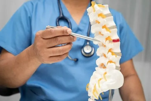 Chiropractor demonstrating a herniated disc on an anatomical spine model.