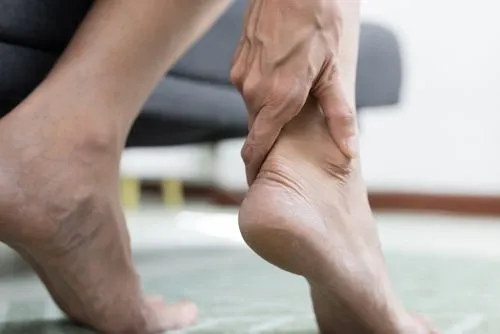 plantar fasciitis in in Fort Myers, FL