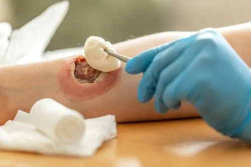 Doctor providing wound care to patient