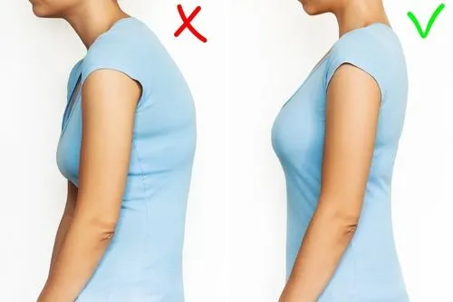 Before and after posture correction comparison of a woman