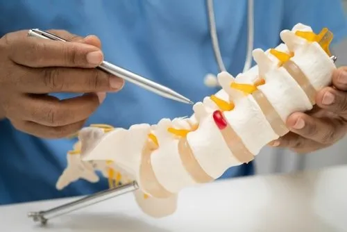 Chiropractor demonstrating herniated disc using spinal nerve and bone model.