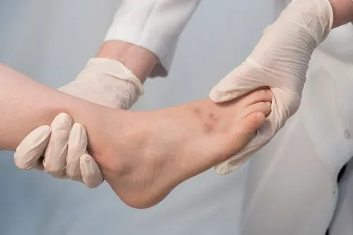 Illustration of Foot Fracture on person