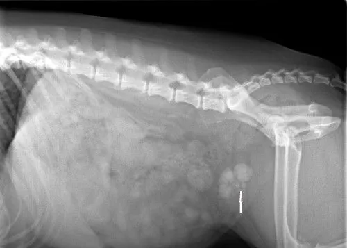 Bladder stones prior to surgery