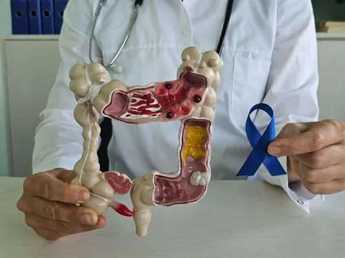 Gastroenterologist holding a colon model and blue awareness ribbon promoting colon cancer screening