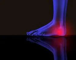 heel pain