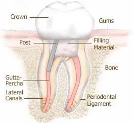 Root Canals diagram Lehi, UT