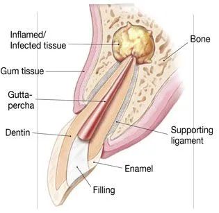 endo1.jpg