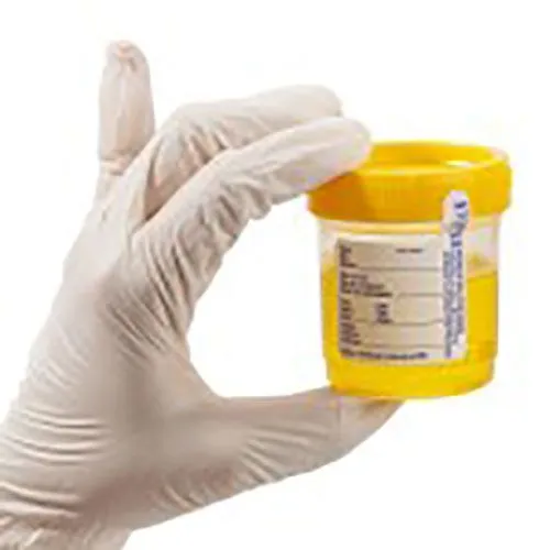 CDL Medical Card Urinalysis