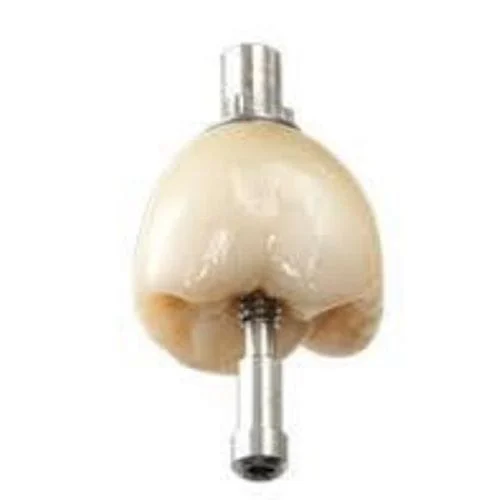 Dental Implant Creve Coeur, MO