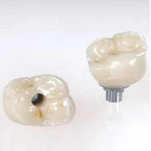 Dental Implants Creve Coeur, MO