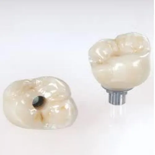 Dental Implants Creve Coeur, MO