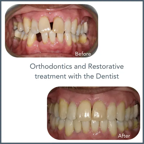 ortho.restorative