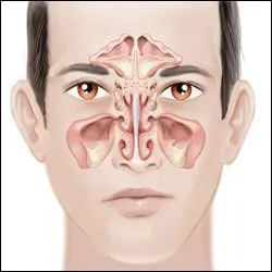 Thousand Oaks, Simi Valley, Oxnard, & Camarillo, CA sinus surgery