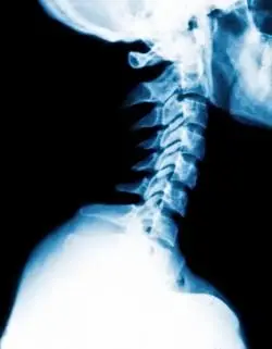 neck x-ray