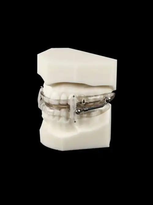 sleep apnea oral appliance Great Falls, VA