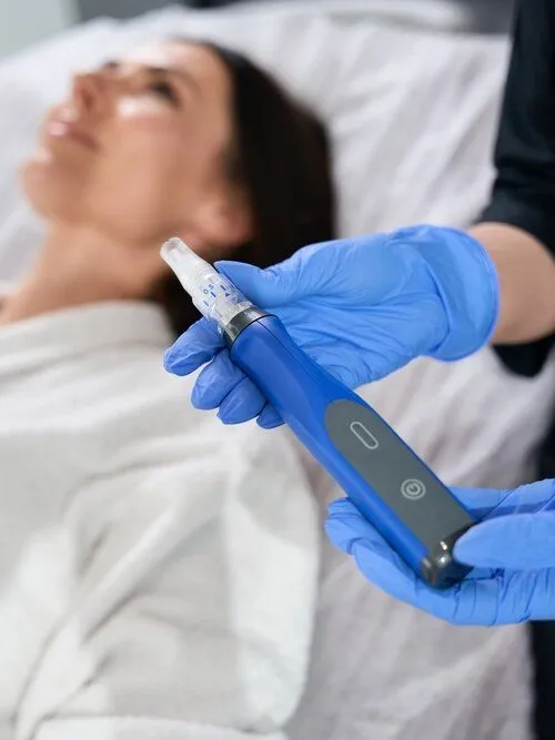 Microneedling with PRP