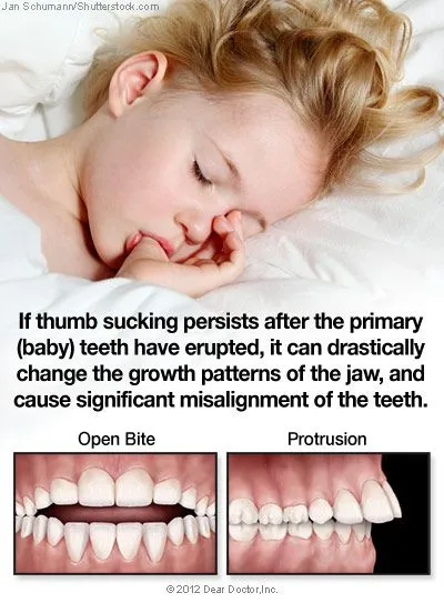 thumb-sucking-thumb