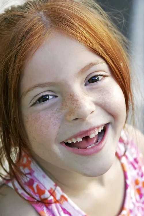 Missing Tooth - Pediatric dentistry in Pooler, GA