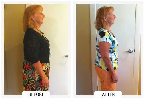 ChiroThin Weight Loss Program at Gallagher Chirpractic