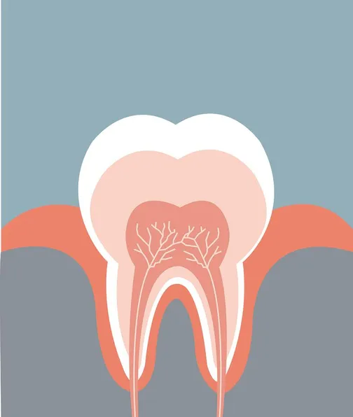 Root Canals Salt Lake City UT | Dentist