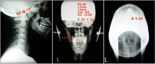 3d Digital Xray Analysis