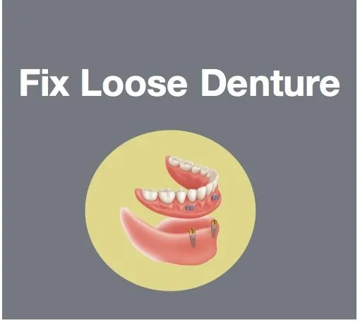 Fix Loose Dentures with Implants