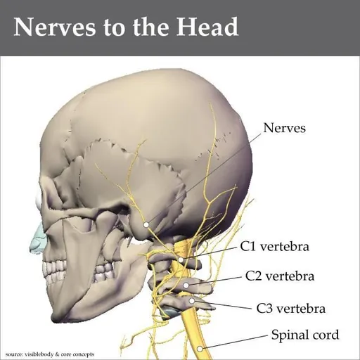 headache