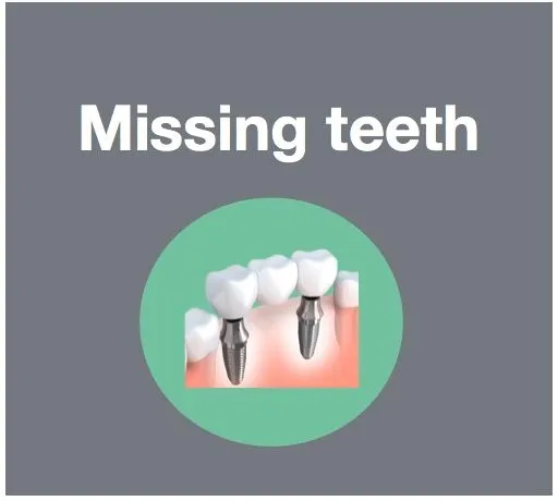 Replace missing teeth with implants