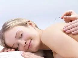 sugar_land_acupuncture.jpg