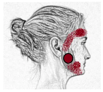 jaw pain mimicking sinus pain