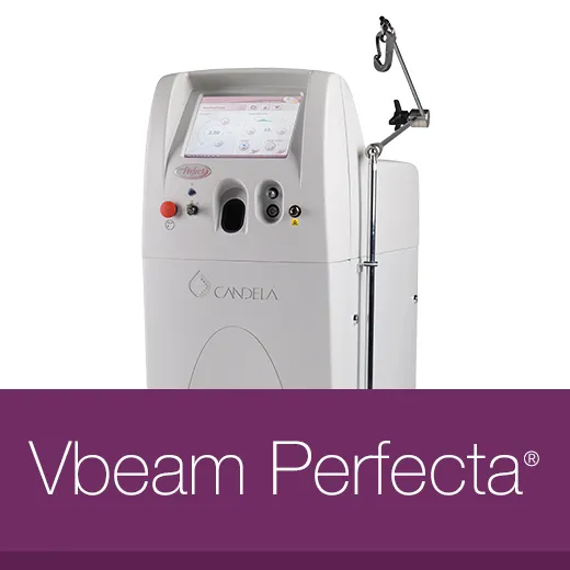 VBeam Perfecta Laser Machine