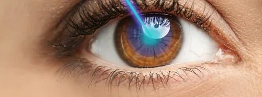 Eye with laser