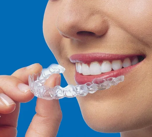 Invisalign