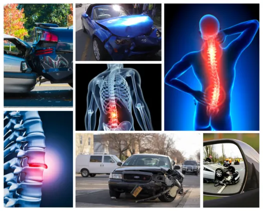 auto injury, auto accident, mva doctor and chiropractor for pain at Stoneview Injury and Wellness Clinic