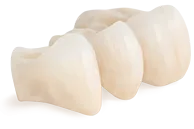 Dental Bridges Fort Collins